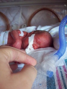 360px-Premature_infant_with_ventilator
