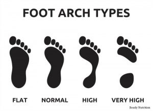 foot arch types1
