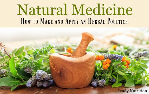 Natural Medicine: How to Make and Apply an Herbal Poultice