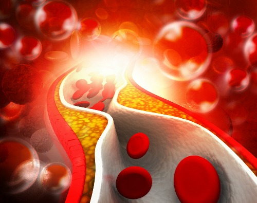 Keeping Control of Cholesterol Naturopathically