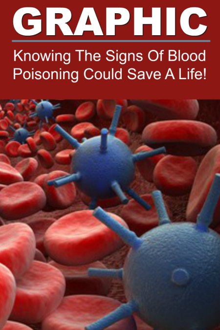 Blood poisoning can be deadly and is not all that uncommon. Therefore, knowing the signs of blood poisoning can save a life, as one mother in the United Kingdom recently found out!