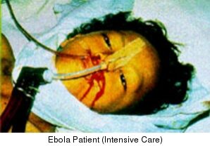 020406ebola