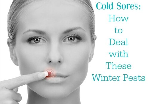 cold sores