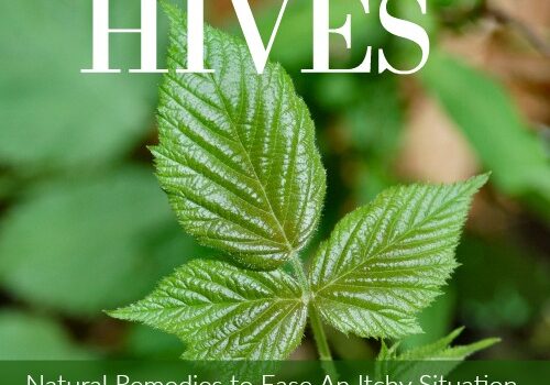 hives1