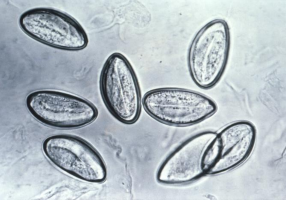 pinworm eggs wikimedia